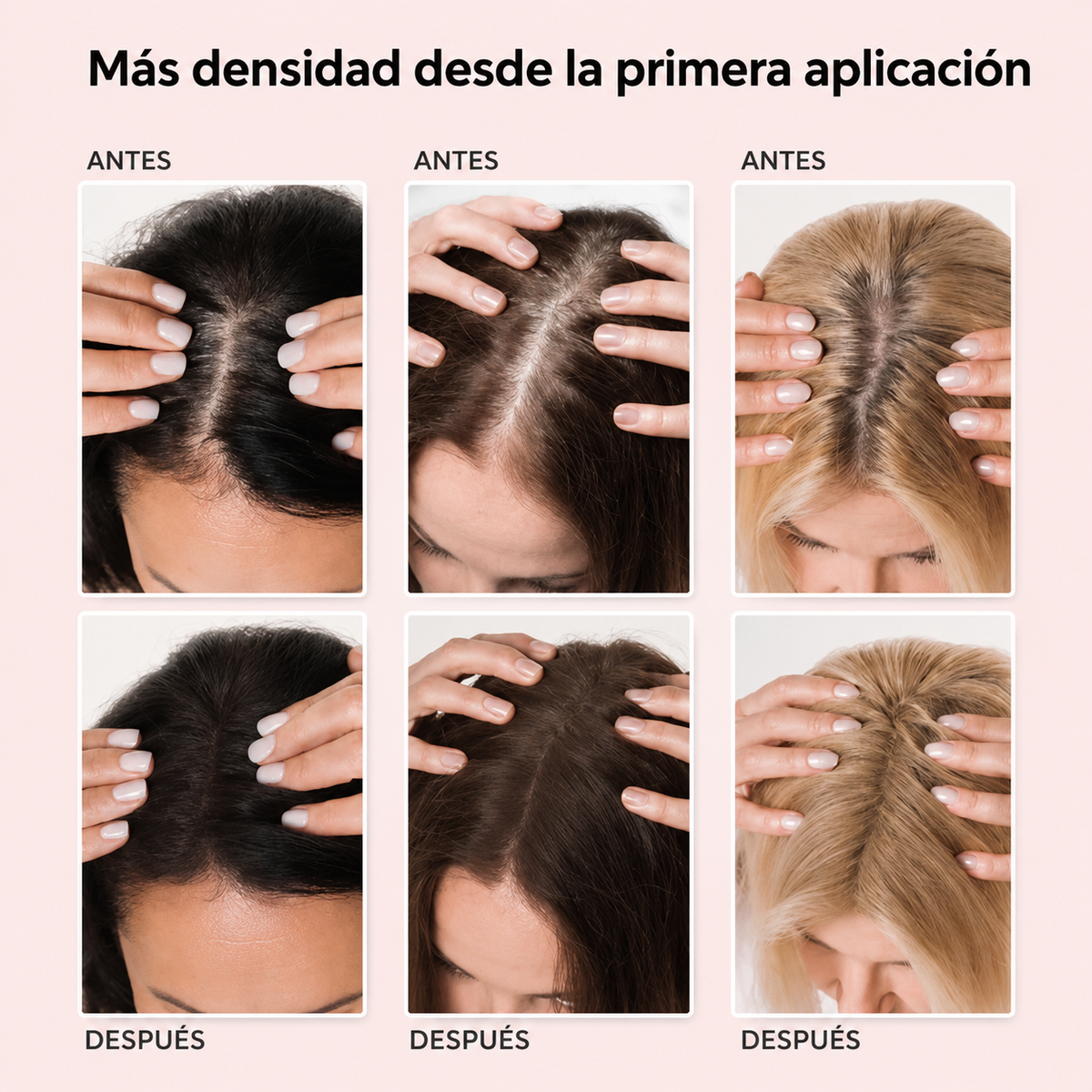 HairMagic Densificador Capilar